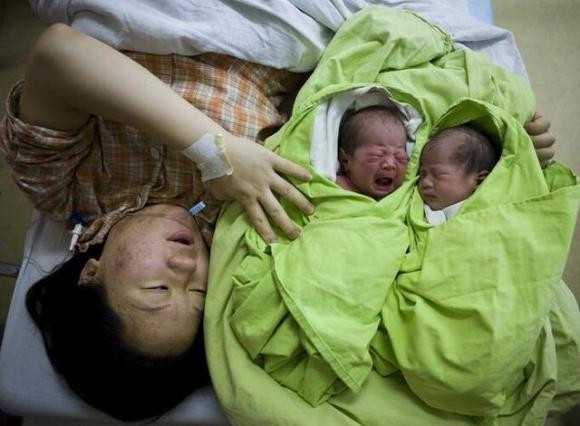 广州人工受孕混血宝宝：避免新生儿黄疸、湿疹