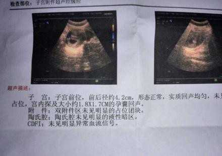 广州高新代妈招聘,不要小看蛋白质，孕期特别重